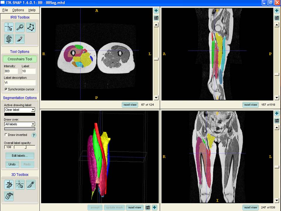 Ongoing Research | Muscle and Mobility Research